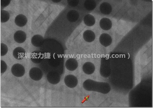 BGA因?yàn)楹笁|變小，造成錫膏過多而最終形成焊接短路的結(jié)果。